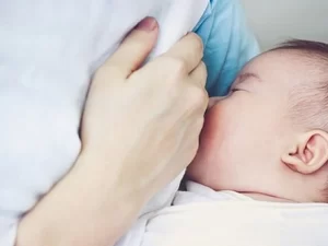 ماموپلاستی در دوران شیردهی