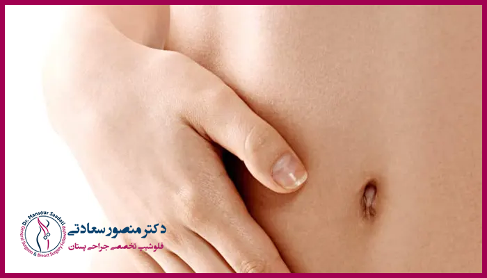چرا ناف بعد از ابدومینوپلاستی دچار عفونت می شود؟