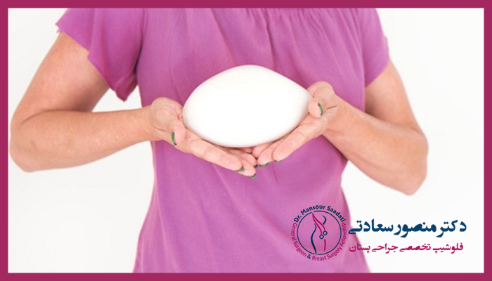 ماندگاری پروتز سینه