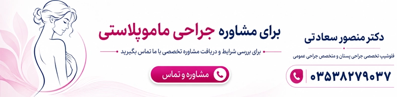 مشاوره برای جراحی ماموپلاستی