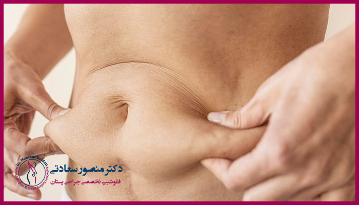 چرا نحوه خوابیدن بعد از ابدومینوپلاستی اهمیت دارد؟