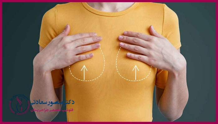 مزایای جراحی همزمان لیفت و پروتز سینه