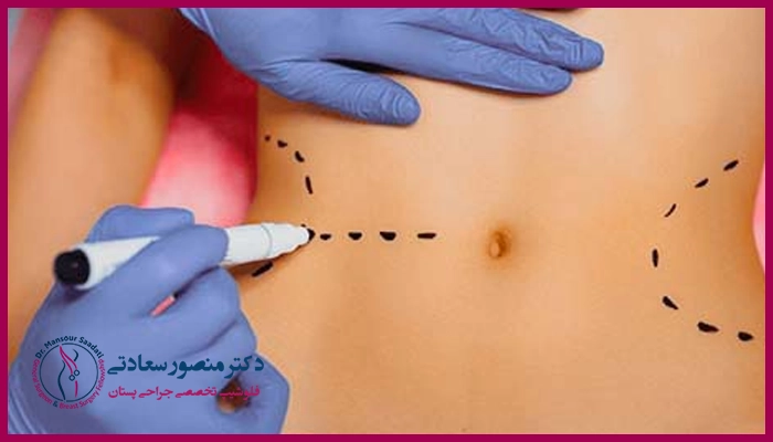 چگونه بهترین دکتر پیکرتراشی در یزد را پیدا کنیم؟